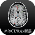 影像解剖图谱app免费版下载_影像解剖图谱app下载 v4.3.1最新版